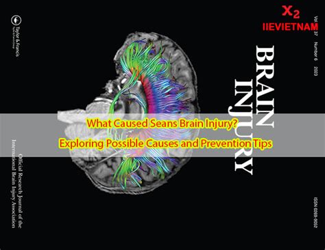 Despite a lack of obvious structural damage in routine <b>brain</b> scans, the study. . What caused seans brain injury